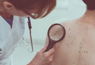 Semana da Saúde: entrevista desta quinta-feira é com especialista em dermatologia