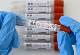 40 novos casos de coronavírus são confirmados em Toledo