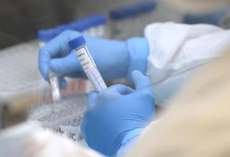 Toledo registra primeira morte por H3N2