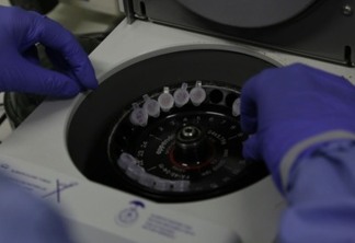 Fiocruz detecta infecção com potencial pandêmico em paranaense