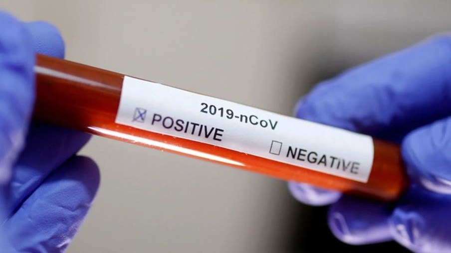 Nove novos casos de coronavírus são registrados em Toledo