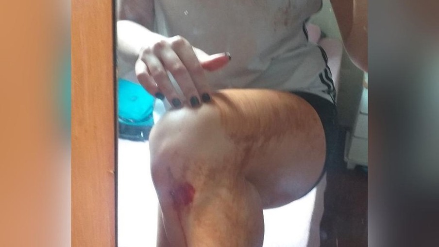 Jovem é atacada por homem e fica ferida enquanto praticava exercícios físicos em Londrina