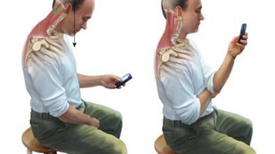 Unopar Cascavel alerta população sobre uso de celulares e dores no corpo
