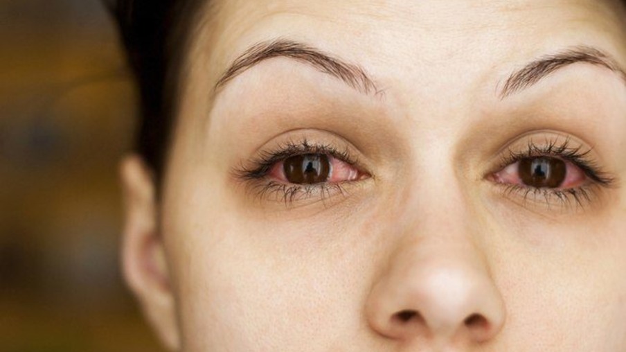Diagnóstico do olho seco ganha mais precisão