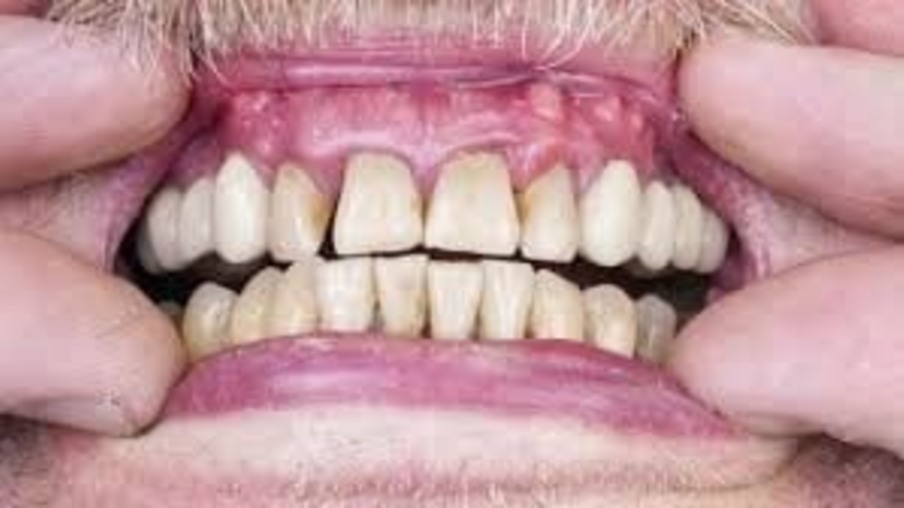 Você sabe reconhecer qual é a idade do seu dente?