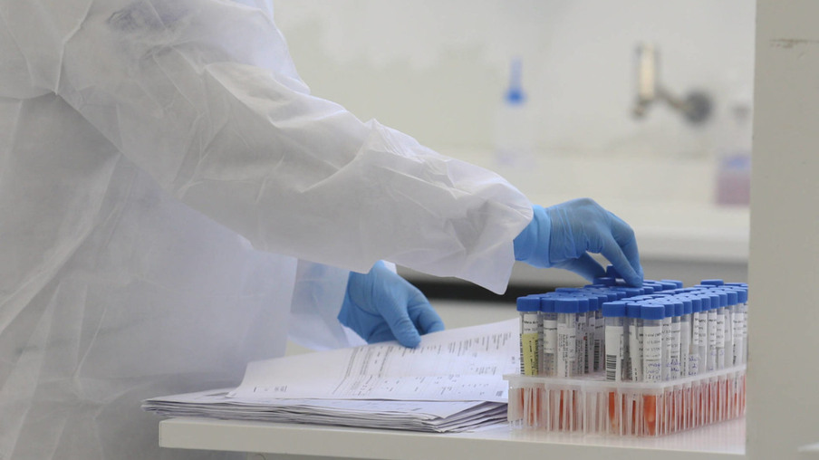Paraná alcança 17 laboratórios credenciados para testes da covid-19