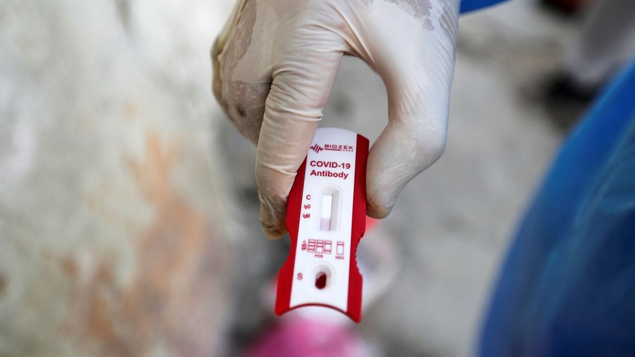Foz registra 82 novos casos de Coronavírus em 24 horas