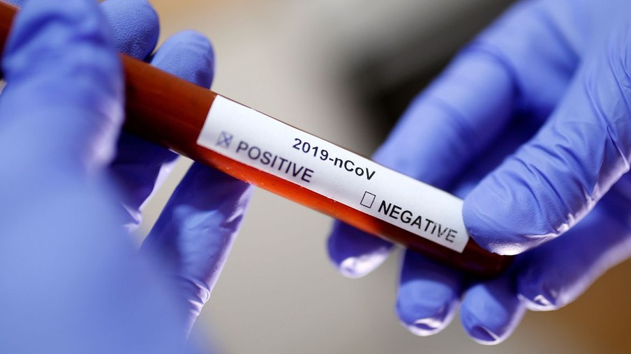 34 novos casos de coronavírus são confirmados em Toledo