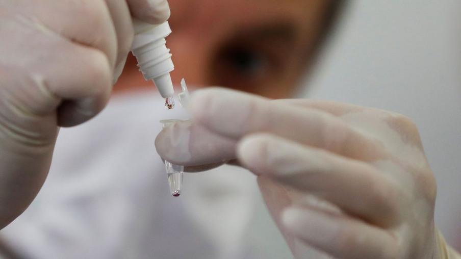 Unioeste começa oferecer exames RT-PCR a baixo custo