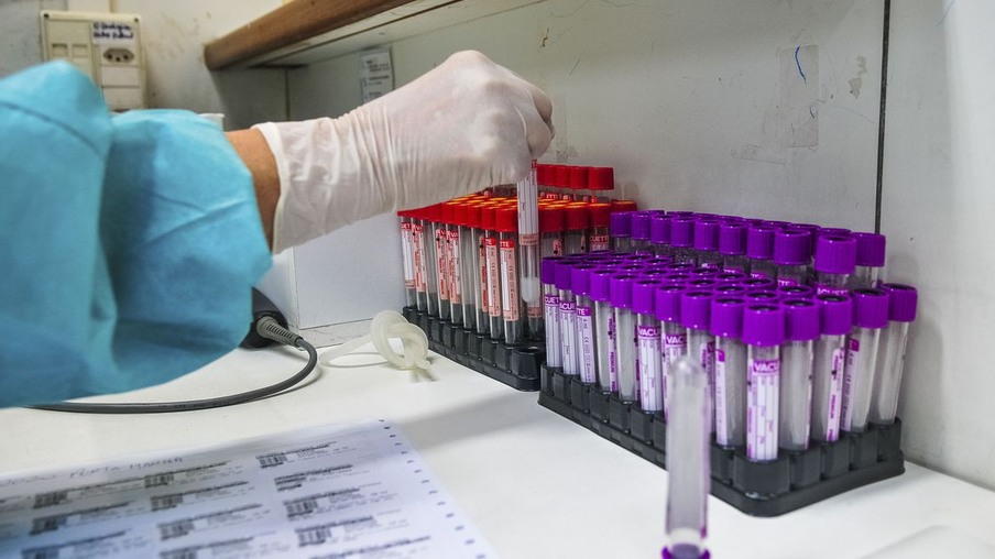 10 novos casos de coronavírus são registrados em Toledo