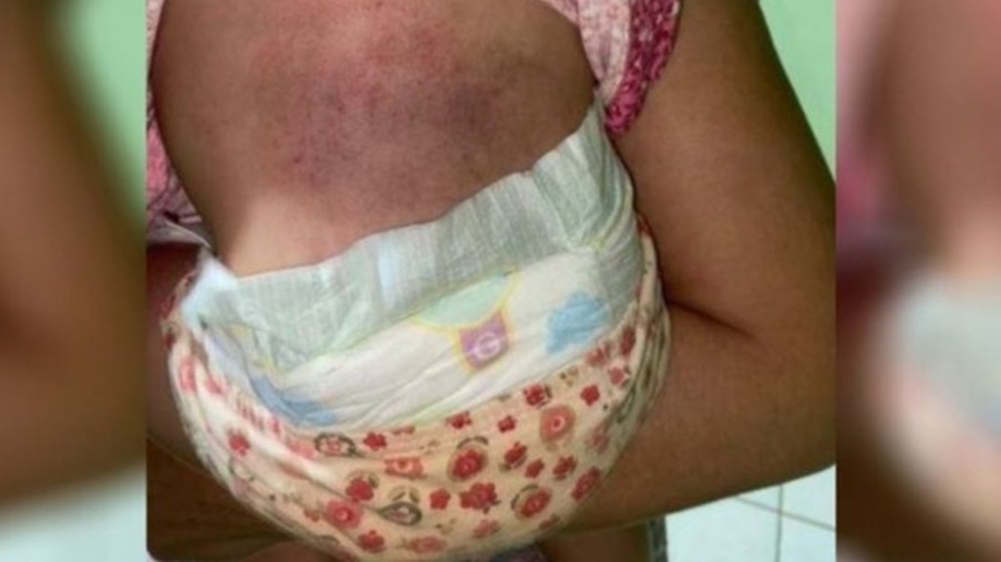 Vizinha ouve gritos e mulher acaba detida por agredir filha bebê no Paraná