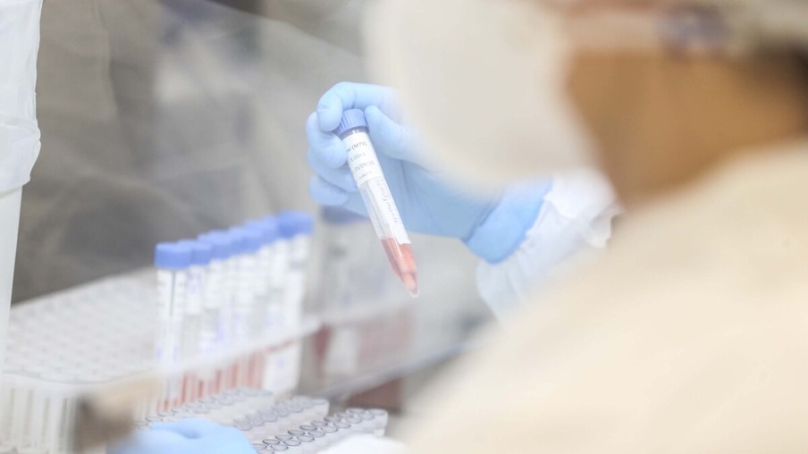 Laboratório Central do Estado - LACEN  -  Recepção  de amostras para teste do Coronavirus. 
Foto: Geraldo Bubniak/AEN