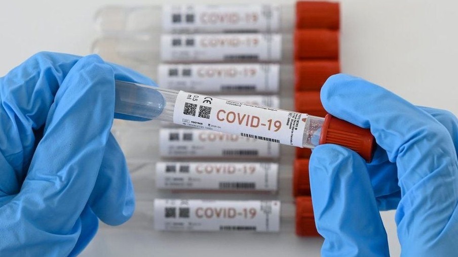 Cientistas descobrem nova linhagem com mutação do coronavírus no Brasil