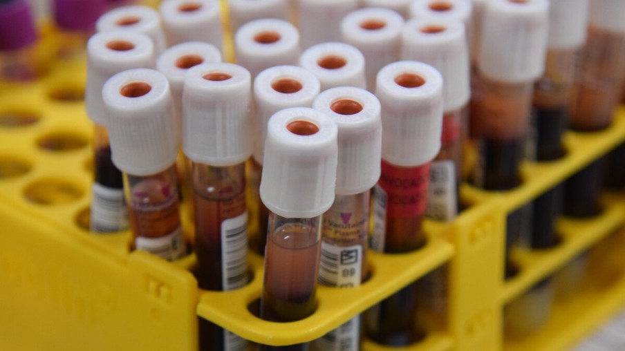 Coleta de sangue no Hemocentro de Cascavel teve queda em 2020
