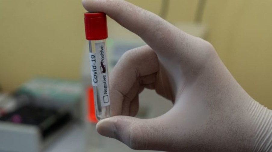 Foz registra 83 novos casos e uma morte por Coronavírus em 24 horas