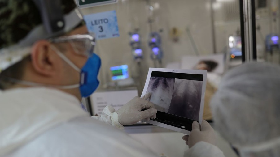O chefe do médico da UTI, Everton Padilha Gomes, examina uma radiografia de tórax de um paciente em um hospital de campo criado para tratar pacientes que sofrem da doença por coronavírus (COVID-19) em Guarulhos, São Paulo
