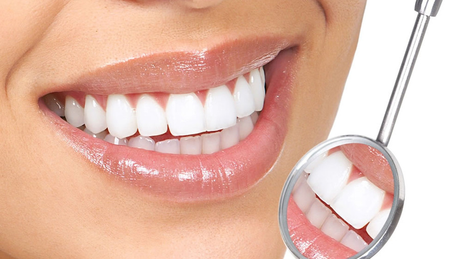 Lentes de contato dentais contribuem para aumento da autoestima