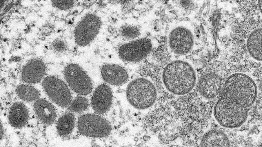 Brasil registra 978 casos de varíola dos macacos