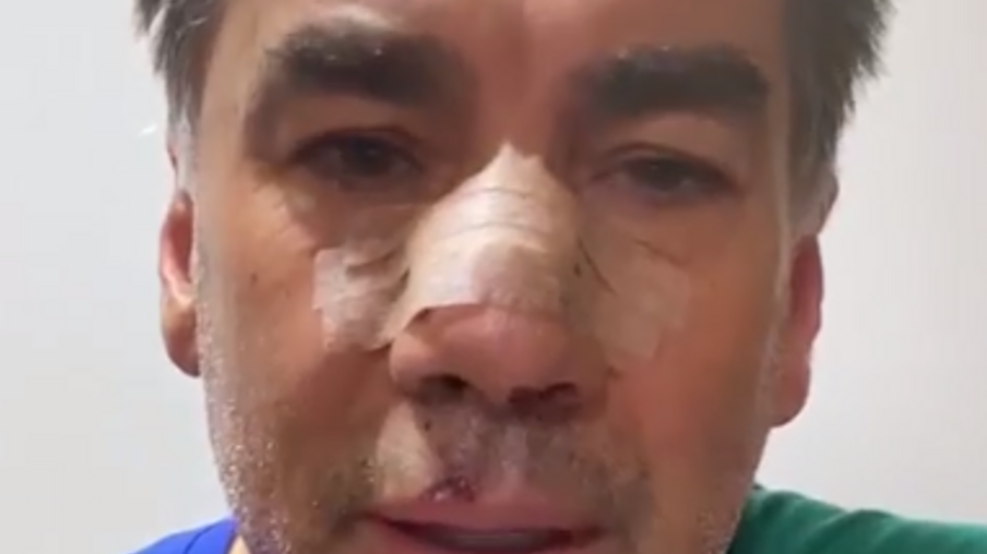 Paranhos fala sobre lesões no nariz e na cervical após queda; veja vídeo