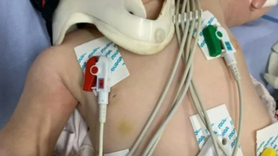 Médica chama a polícia depois de atender bebê com mais de 30 lesões